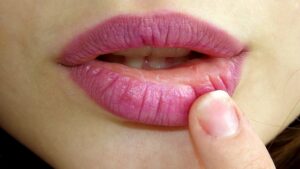 metody powiększania ust